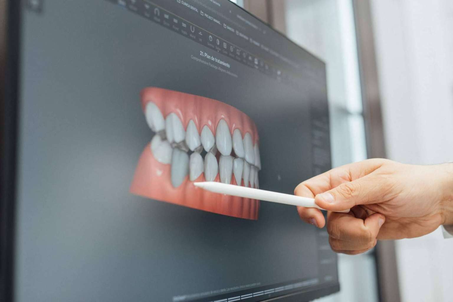 Todo lo que hay que saber sobre la ortodoncia invisible en Barcelona, con Clínica Dental Claris